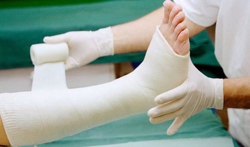 Gãy xương chân là chấn thương ảnh hưởng nhiều đến hoạt động đi lại thậm chí thành tật