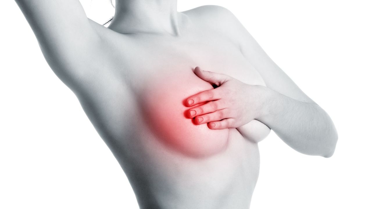 Dấu hiệu ung thư vú ở phụ nữ phần lớn gặp ở nữ giới