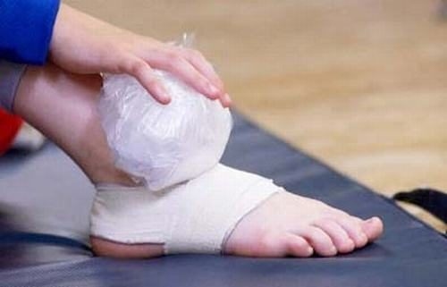 Bong gân mấy ngày KHỎI HẲN & Cách Chữa NHANH nhất