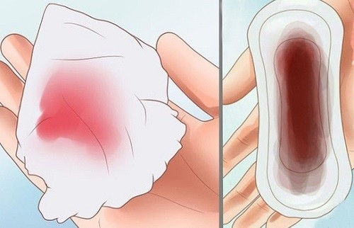 Máu báo thai thường có màu nâu đỏ hoặc đỏ hồng.