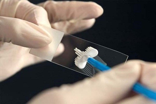Xét nghiệm Pap là gì?Độ tuổi nào nên làm xét nghiệm