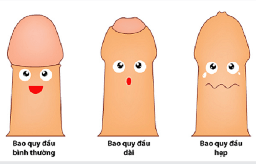 Khi đang băn khoăn có nên cắt bao quy đầu không, nam giới cần theo dõi và xác định tình trạng bao quy đầu của mình