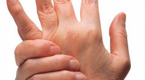 lớn người bệnh Still gặp phải triệu chứng đau khớp