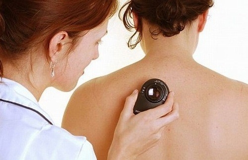 Sinh thiết là một trong những biện pháp giúp chẩn đoán sớm ung thư da