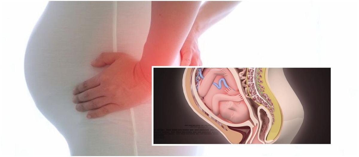 Đau xương mu ở bà bầu có sao không? điều cần quan tâm
