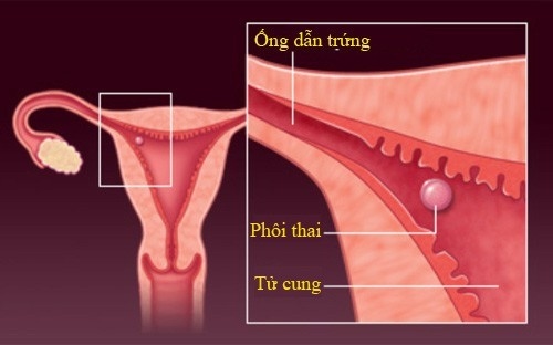 Quá trình thụ thai tính từ khi trứng thụ tinh đến khi mà phôi thai đã được làm tổ được tử cung