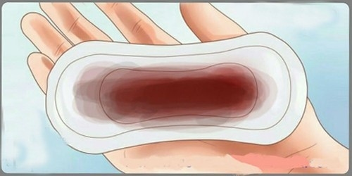 Ra máu màu nâu khi mang thai là hiện tượng nhiều mẹ bầu từng gặp phải