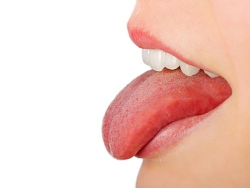 Ung thư lưỡi có chữa khỏi được không?