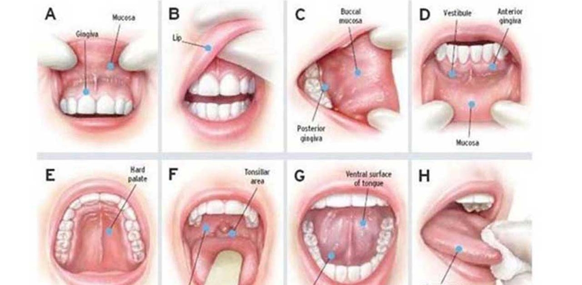 Khám ung thư lưỡi ở đâu? tại Bệnh viện Thu Cúc