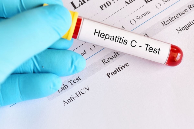 Xét nghiệm Anti HCV là gì? Kiểm tra Anti HCV ở đâu tốt nhất