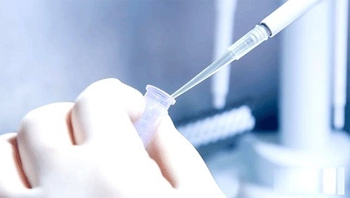 Xét nghiệm bệnh lậu bao nhiêu tiền?
