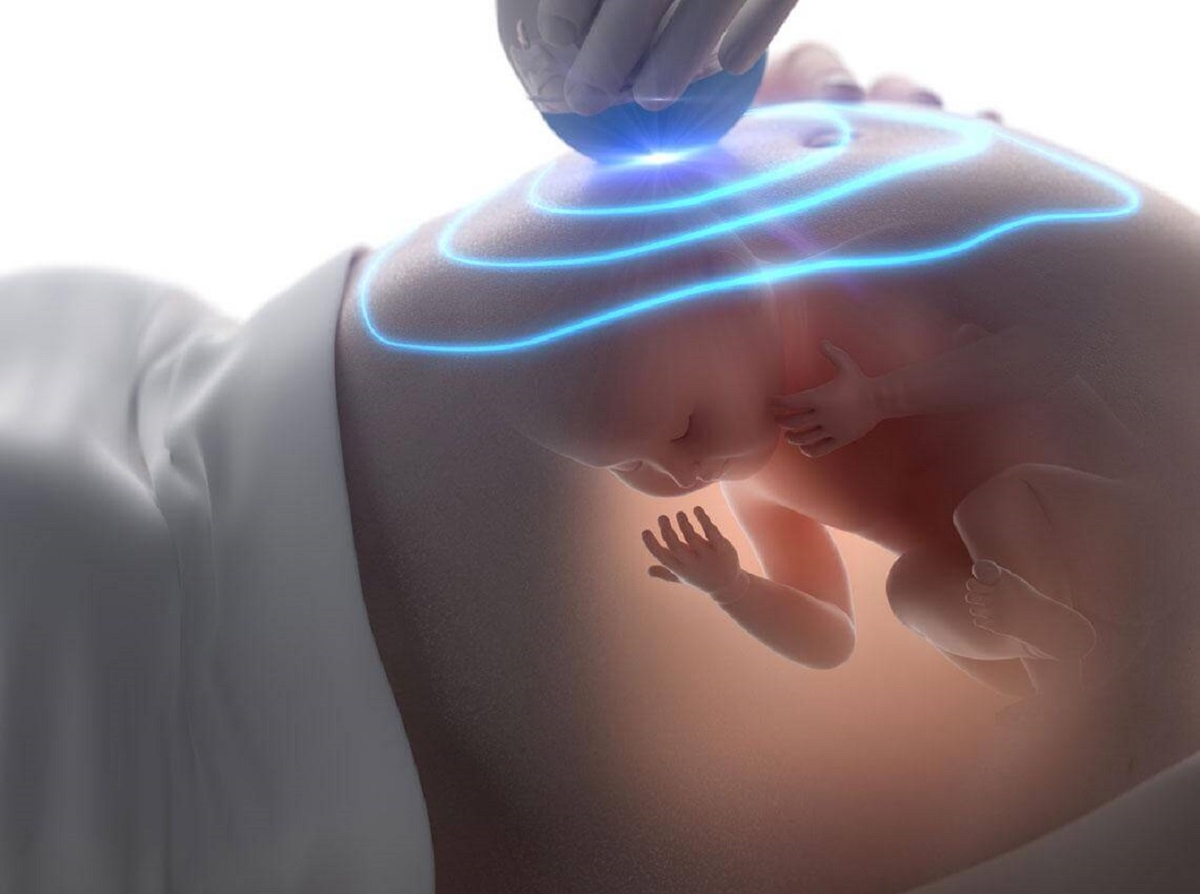 Siêu âm thai có cần nhịn ăn không?