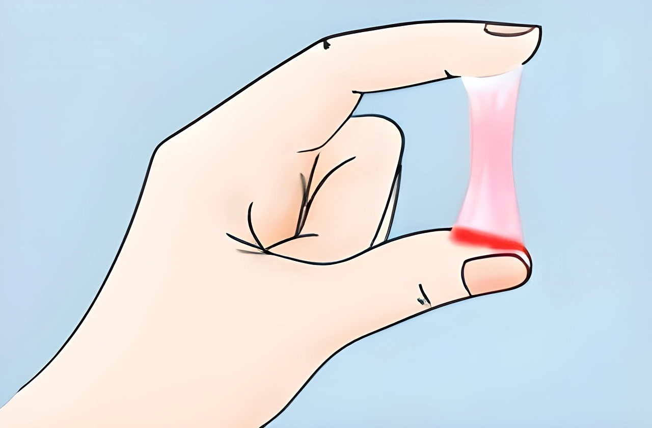 Khí hư có 1 ít sợi máu &#8211; Nguyên nhân và cách xử trí cần biết