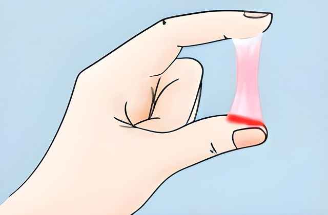 Khí hư có 1 ít sợi máu &#8211; Nguyên nhân và cách xử trí cần biết