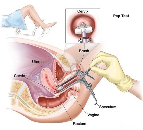 Xét nghiệm tế bào cổ tử cung có đau không?