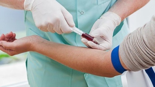 Các chỉ số xét nghiệm sinh hóa máu
