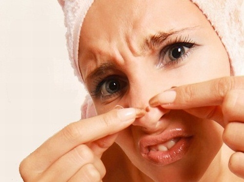 Không dùng tay nặn mụn để tránh để lại sẹo, vết thâm và dễ gây nhiễm khuẩn