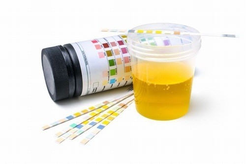 Địa chỉ xét nghiệm chức năng thận uy tín tại Hà Nội