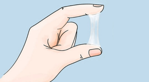 Cách trị bệnh huyết trắng ở phụ nữ ĐÚNG CÁCH và Nhanh khỏi
