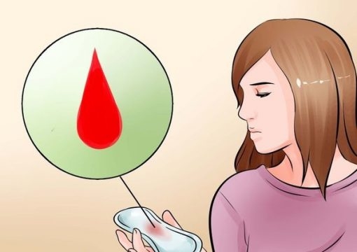 Chảy máu âm đạo bất thường &#8211; đừng chủ quan!