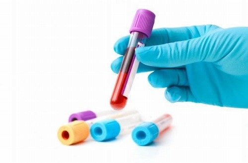 Xét nghiệm chỉ số ast, alt cảnh báo tình trạng sức khỏe