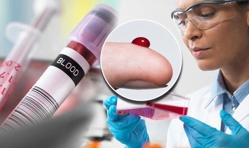 Xét nghiệm máu chẩn đoán chỉ số lym thấp hay cao