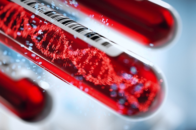 Xét nghiệm hiv mất bao nhiêu tiền? Bảng Giá Chính Xác