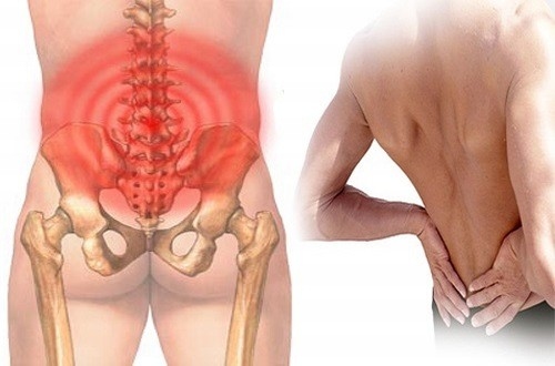Đau xương cụt là bệnh gì? Có nguy hiểm không?