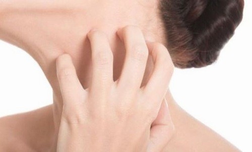Hắc lào gây cảm giác khó chịu, ngứa ngáy cho người bệnh. 