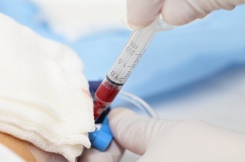 Xét nghiệm ggt là gì? thông tin hữu ích