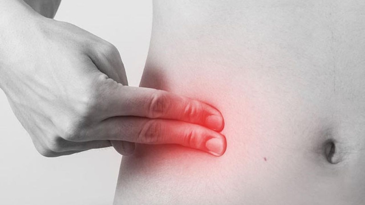 Đau bụng dưới bên phải và nguyên nhân