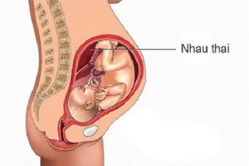 Nghiệm pháp lọt ngôi chỏm &#8211; Thủ thuât bấm ối sớm