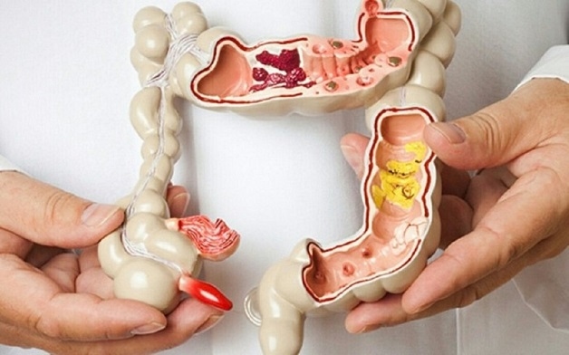 đại tràng là gì