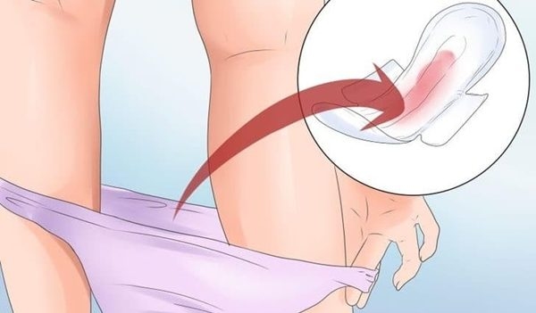 Xuất huyết âm đạo bất thường là một trong những triệu chứng thường gặp ở bệnh nhân ung thư cổ tử cung
