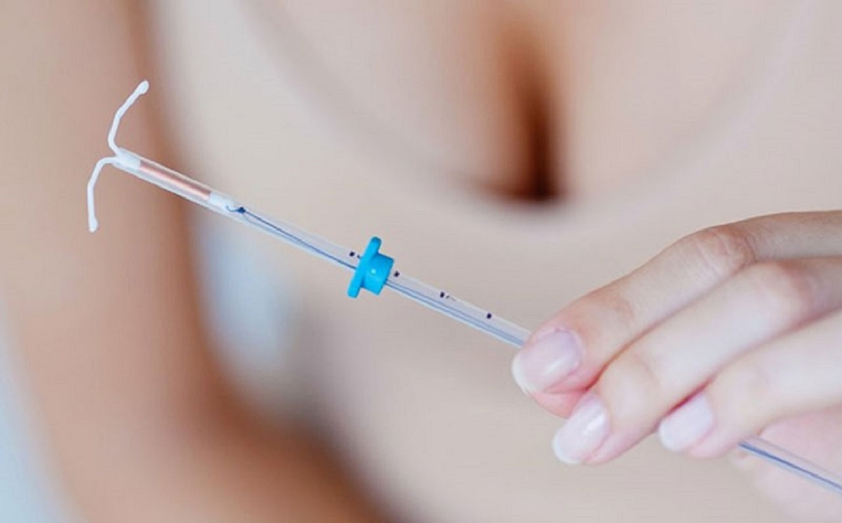 Trước khi đặt vòng có được quan hệ không?