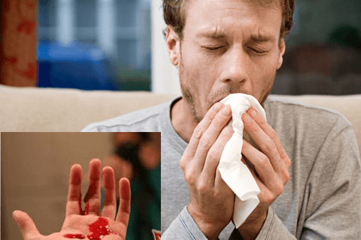 Đờm có máu là bệnh gì? cần được điều trị.