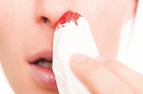 Niêm mạc mũi bị chảy máu có thể do nguyên nhân gây ra cần được chẩn đoán