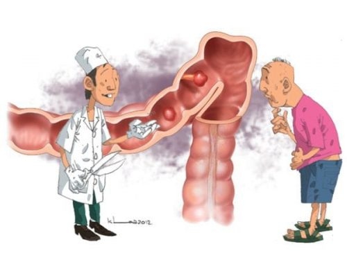 Tắc ruột trên siêu âm