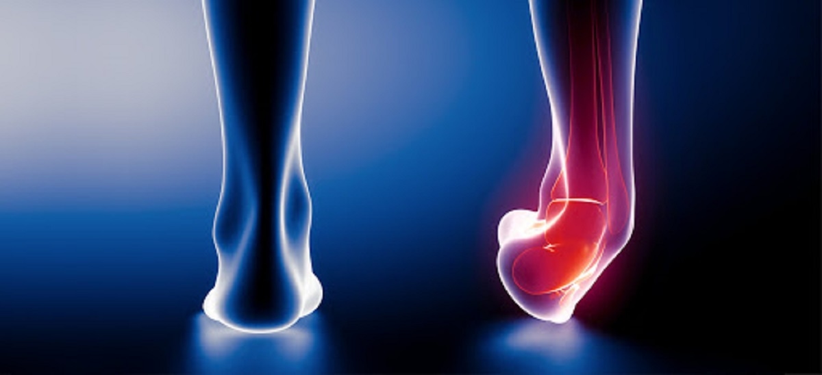 Trật khớp cổ chân phải làm sao? Điều trị như thế nào?