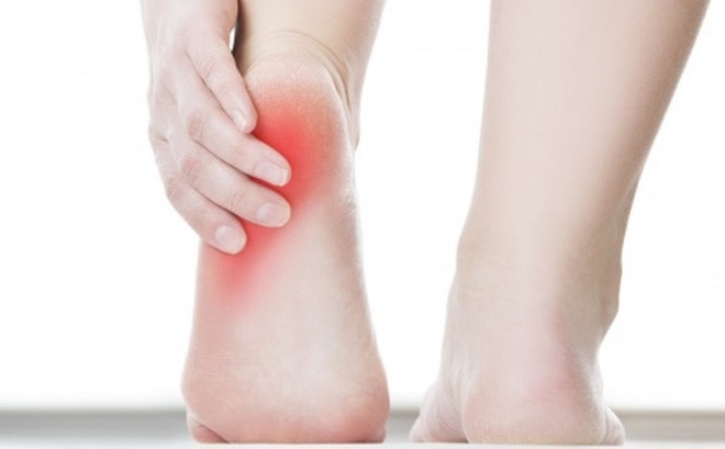 Đau gót chân có thể là dấu hiệu của các bệnh lý như gai