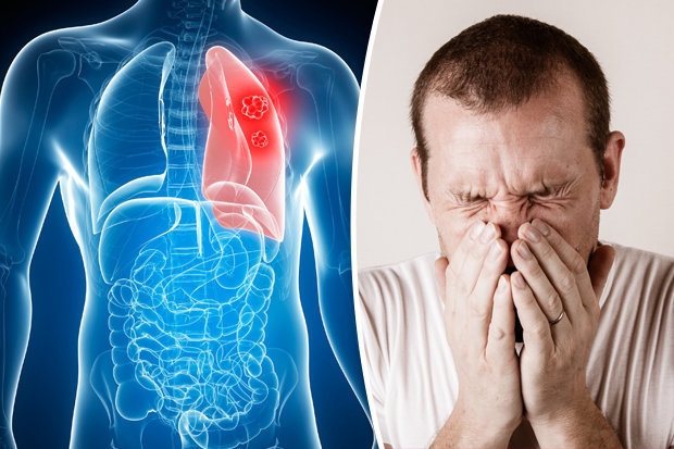 Triệu chứng u phổi lành tính