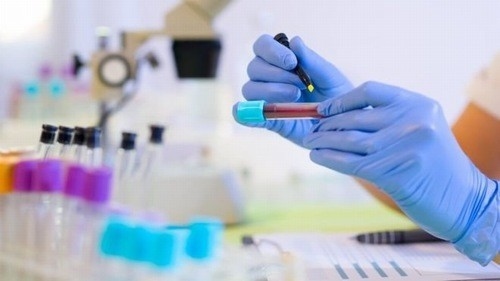 Khi đã biết chính xác bản thân nhiễm virus viêm gan C, người bệnh cần phải điều trị ngay để ngăn ngừa các biến chứng nguy hiểm có thể xảy ra.
