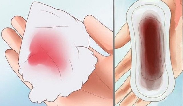 Sinh thường bao lâu hết sản dịch