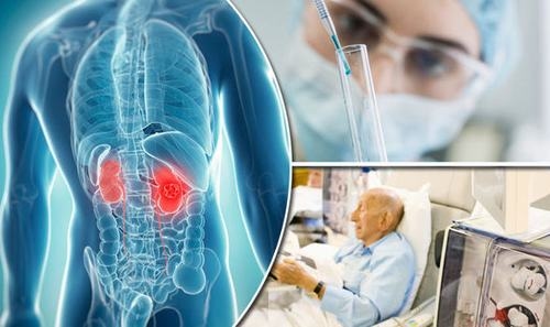 Siêu âm có biết suy thận không - Chẩn đoán hình ảnh