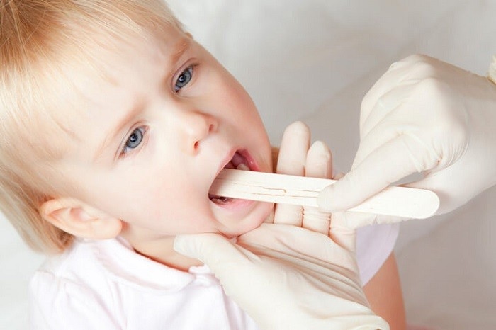 Điều trị viêm VA ở đâu tốt? có con nhỏ bị viêm amidan