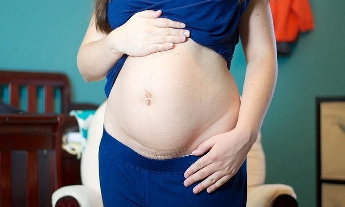 Sinh mổ lần 2 có nguy hiểm không?