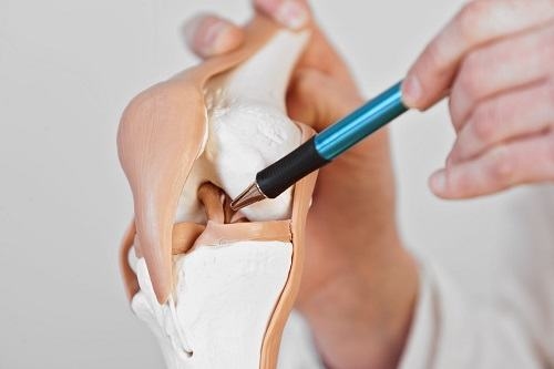 Khi nào cần phẫu thuật cắt bỏ sụn chêm?