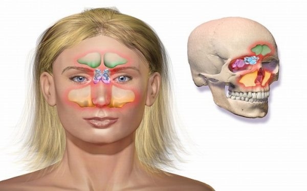 Bệnh viêm xoang bướm do nhiều nguyên nhân gây ra cần được phát hiện sớm và điều trị đúng cách