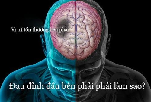 Đau ở đỉnh đầu là triệu chứng từng gặp phải ở không ít người