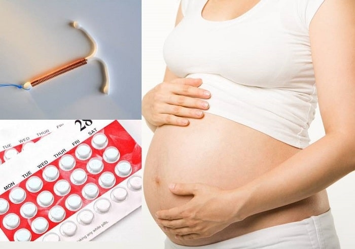 Uống thuốc tránh thai hay đặt vòng còn tùy thuộc vào sức khỏe, lối sống, điều kiện...mỗi người